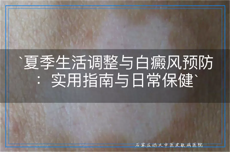 夏季生活调整与白癜风预防：实用指南与日常保健