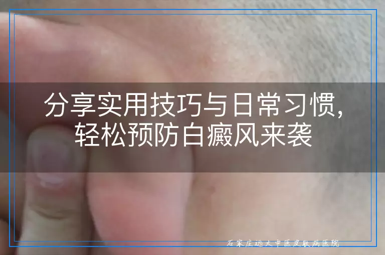 分享实用技巧与日常习惯，轻松预防白癜风来袭