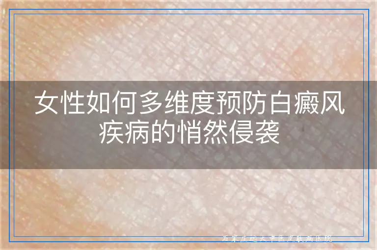 女性如何多维度预防白癜风疾病的悄然侵袭