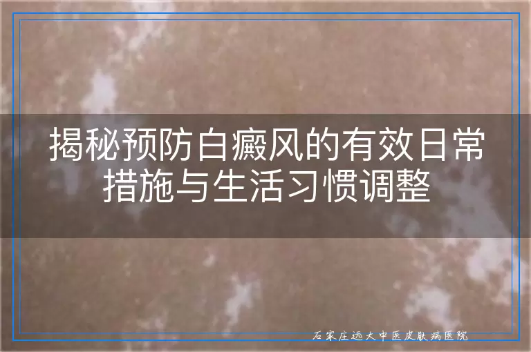 揭秘预防白癜风的有效日常措施与生活习惯调整