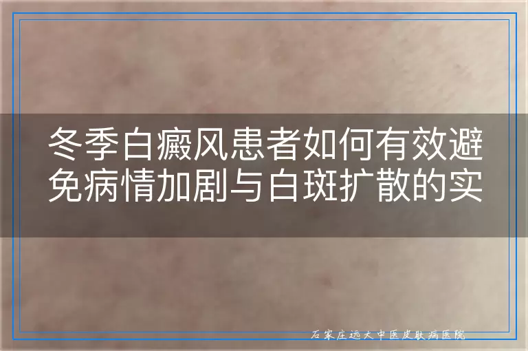 冬季白癜风患者如何有效避免病情加剧与白斑扩散的实用指南