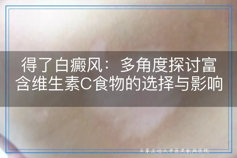 得了白癜风：多角度探讨富含维生素C食物的选择与影响