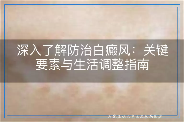 深入了解防治白癜风：关键要素与生活调整指南