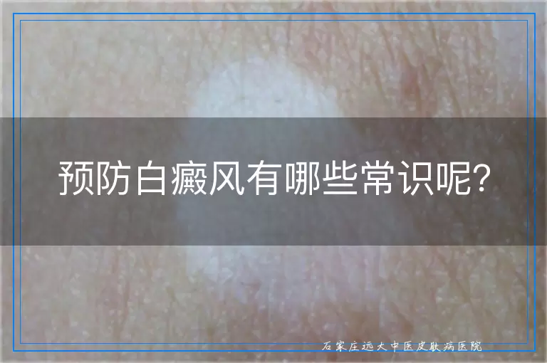 预防白癜风有哪些常识呢？