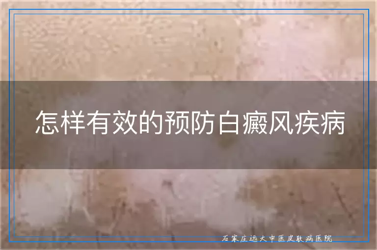 怎样有效的预防白癜风疾病