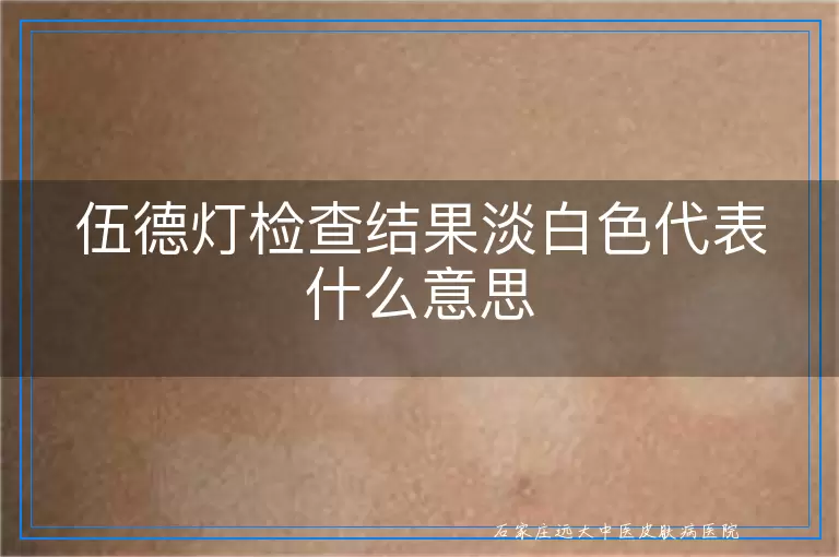 伍德灯检查结果淡白色代表什么意思