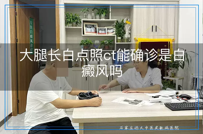 大腿长白点照ct能确诊是白癜风吗