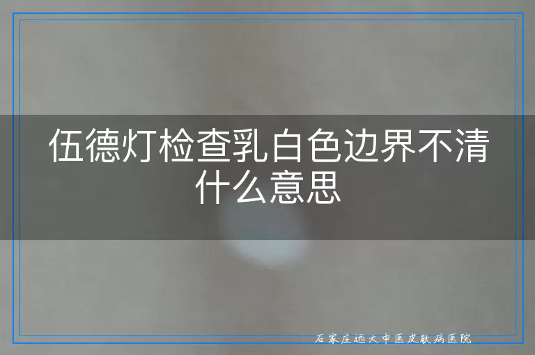 伍德灯检查乳白色边界不清什么意思