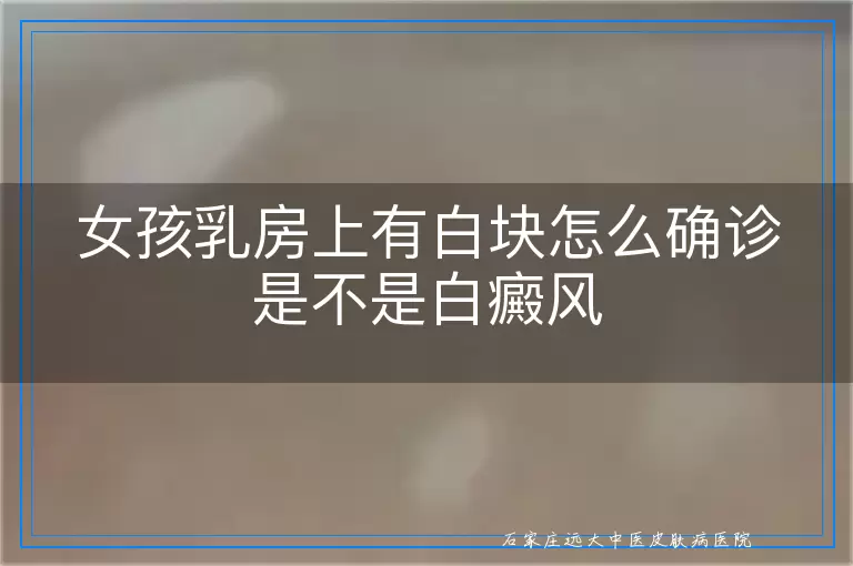 女孩乳房上有白块怎么确诊是不是白癜风