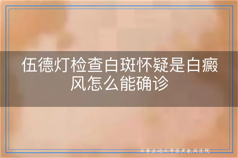 伍德灯检查白斑怀疑是白癜风怎么能确诊