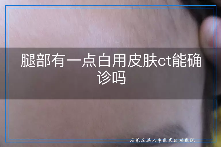 腿部有一点白用皮肤ct能确诊吗
