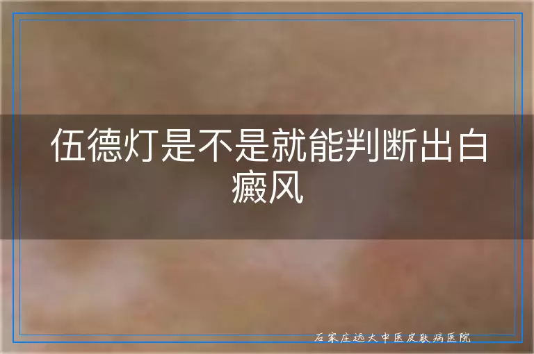 伍德灯是不是就能判断出白癜风