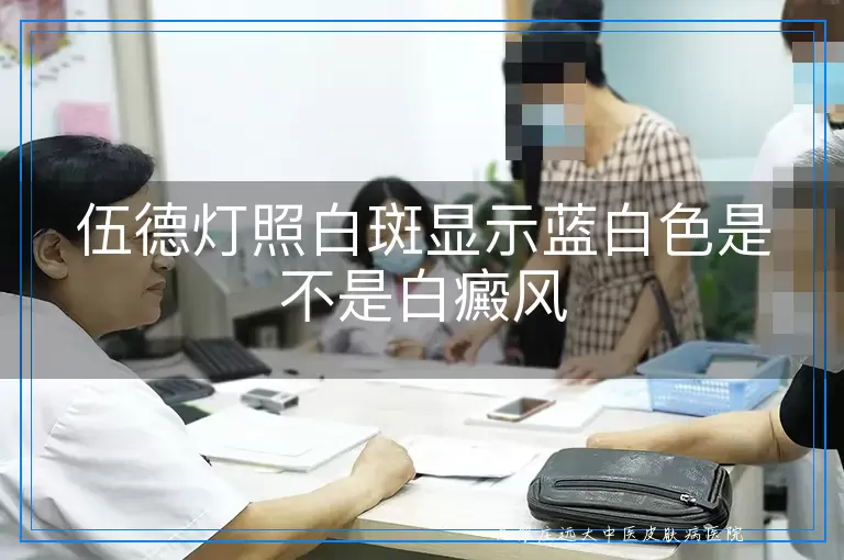 伍德灯照白斑显示蓝白色是不是白癜风