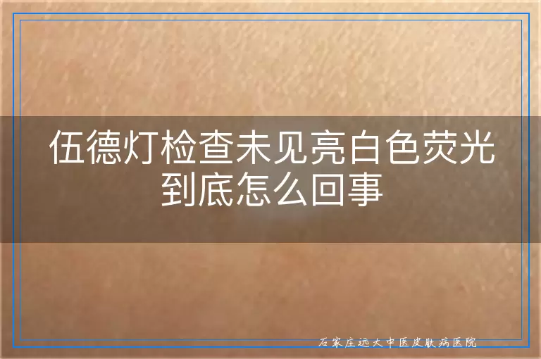 伍德灯检查未见亮白色荧光到底怎么回事