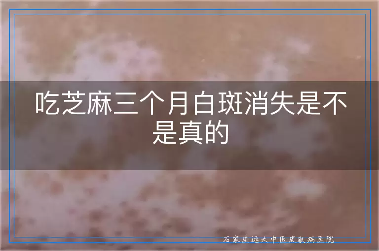 吃芝麻三个月白斑消失是不是真的