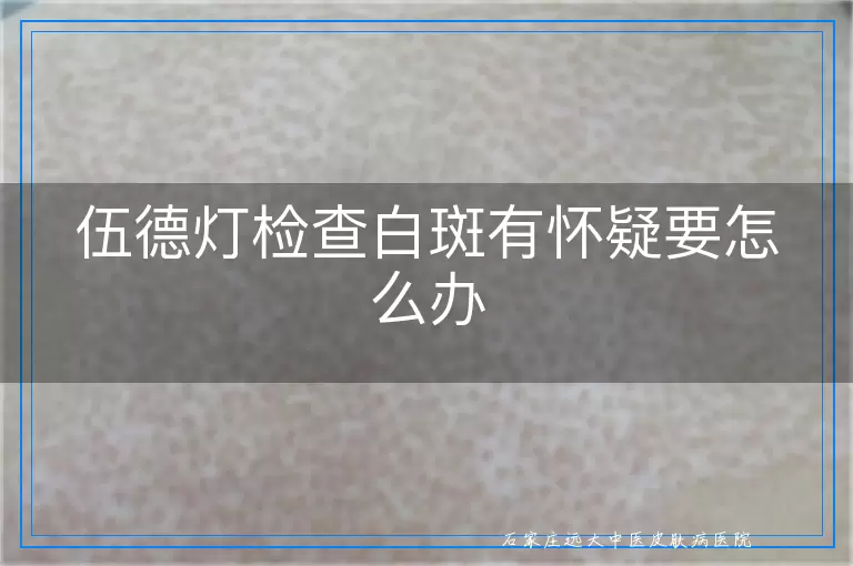 伍德灯检查白斑有怀疑要怎么办