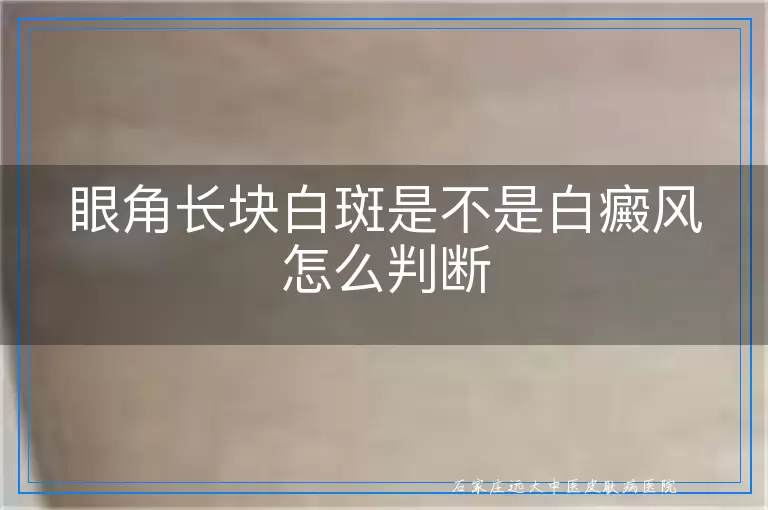 眼角长块白斑是不是白癜风怎么判断