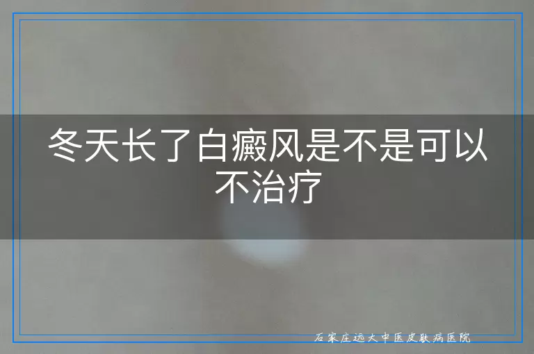 冬天长了白癜风是不是可以不治疗