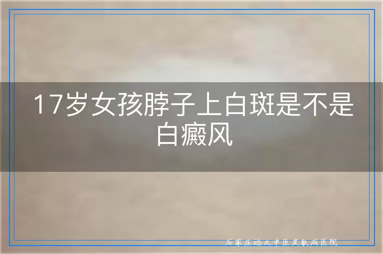 17岁女孩脖子上白斑是不是白癜风