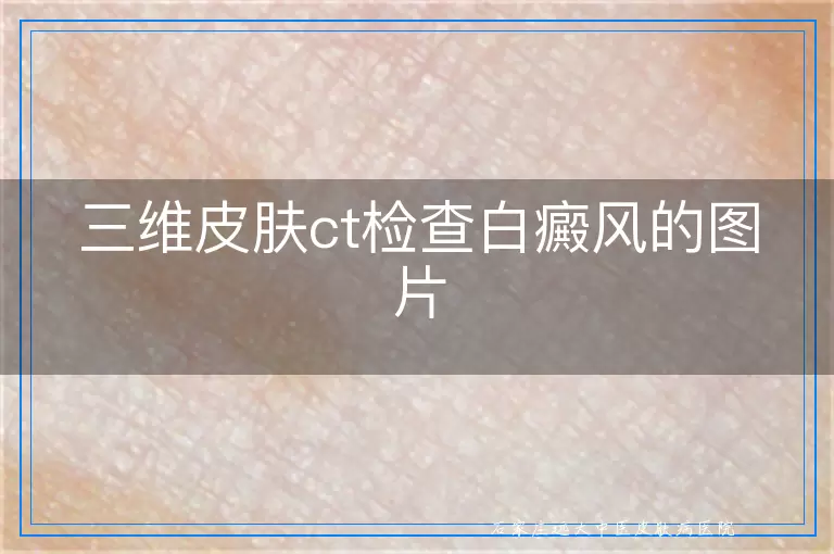 三维皮肤ct检查白癜风的图片