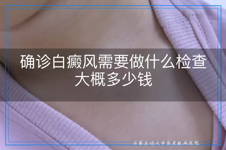 确诊白癜风需要做什么检查大概多少钱