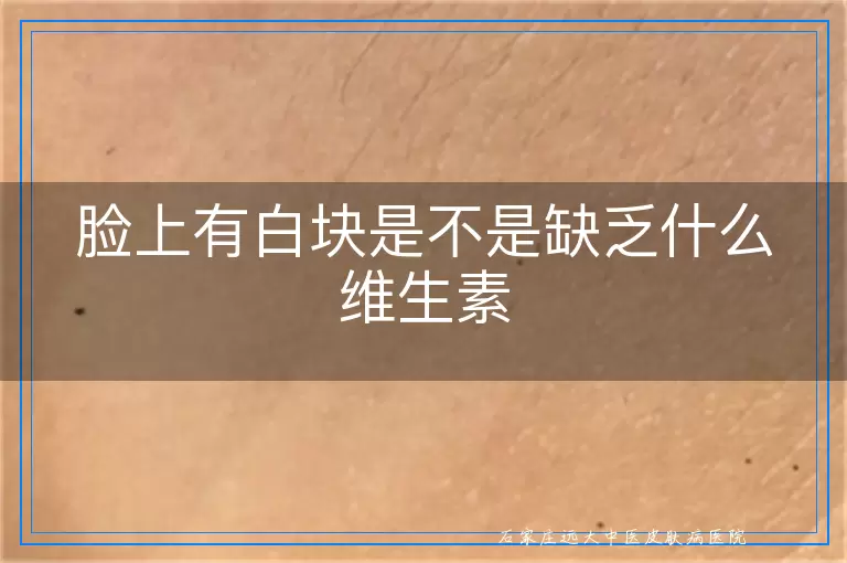 脸上有白块是不是缺乏什么维生素