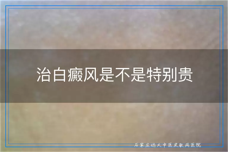 治白癜风是不是特别贵