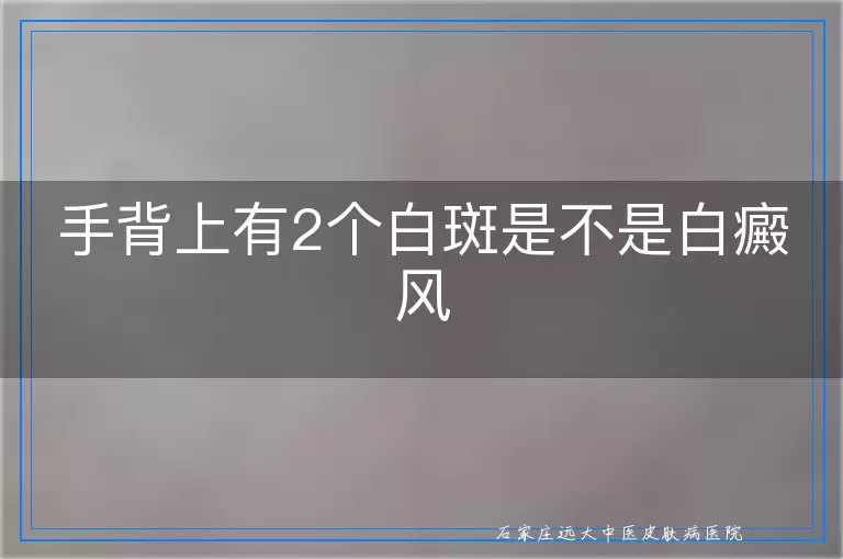手背上有2个白斑是不是白癜风