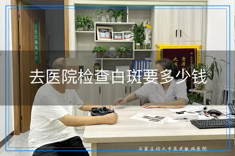 去医院检查白斑要多少钱