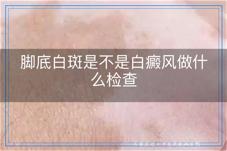 脚底白斑是不是白癜风做什么检查