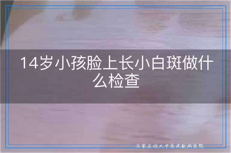 14岁小孩脸上长小白斑做什么检查