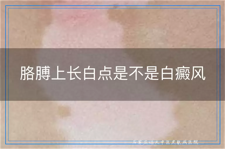 胳膊上长白点是不是白癜风