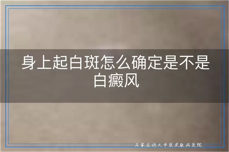 身上起白斑怎么确定是不是白癜风