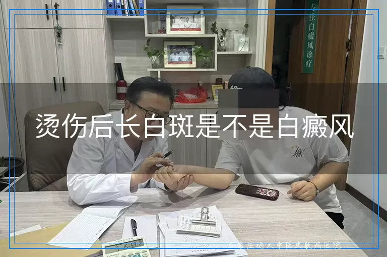 烫伤后长白斑是不是白癜风
