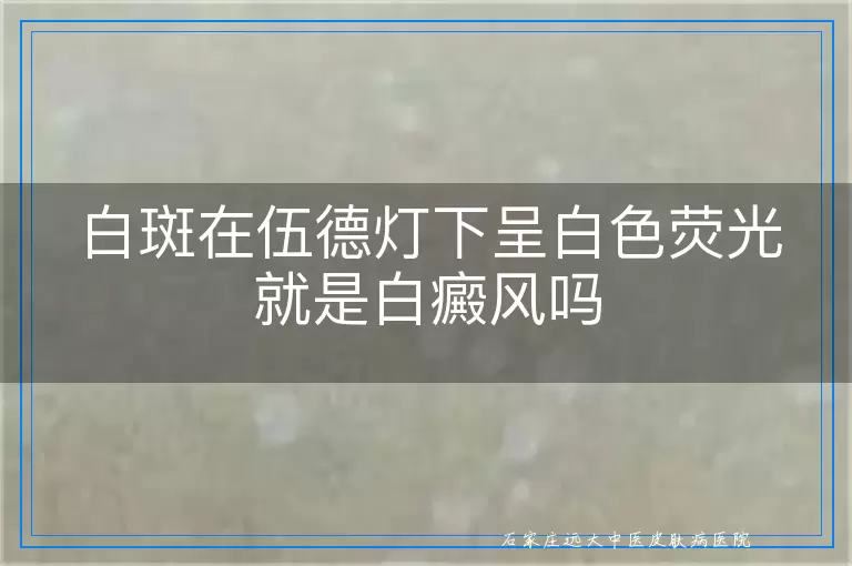 白斑在伍德灯下呈白色荧光就是白癜风吗
