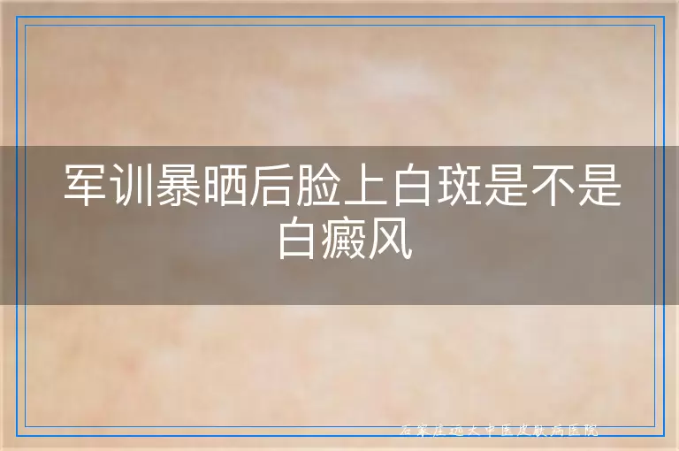 军训暴晒后脸上白斑是不是白癜风