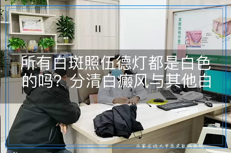 所有白斑照伍德灯都是白色的吗?分清白癜风与其他白斑