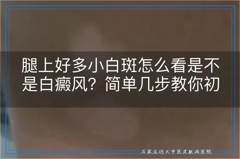腿上好多小白斑怎么看是不是白癜风?简单几步教你初判断