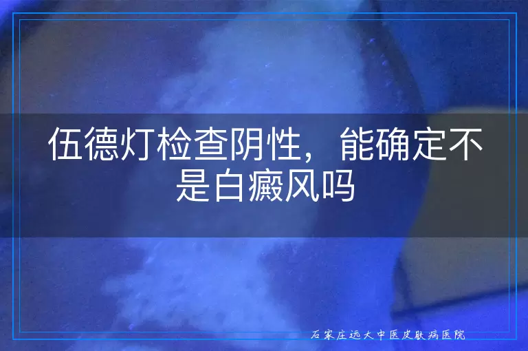 伍德灯检查阴性,能确定不是白癜风吗