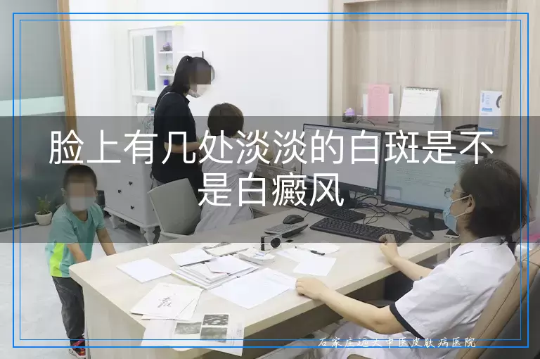 脸上有几处淡淡的白斑是不是白癜风