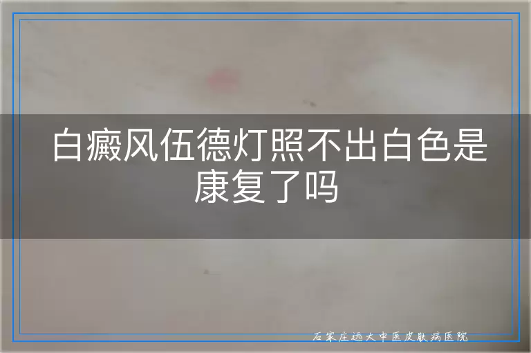 白癜风伍德灯照不出白色是康复了吗