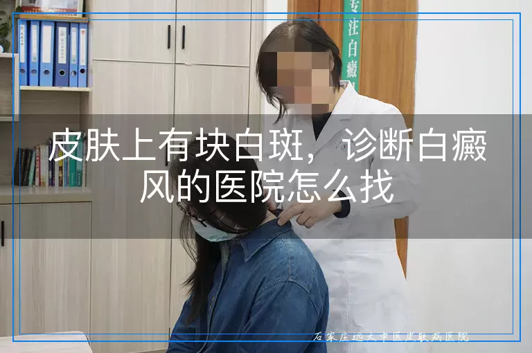 皮肤上有块白斑,诊断白癜风的医院怎么找