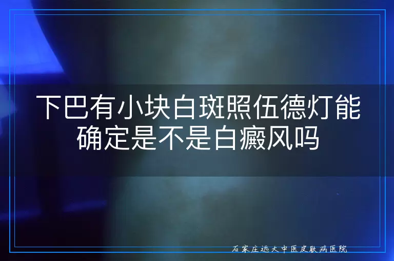 下巴有小块白斑照伍德灯能确定是不是白癜风吗