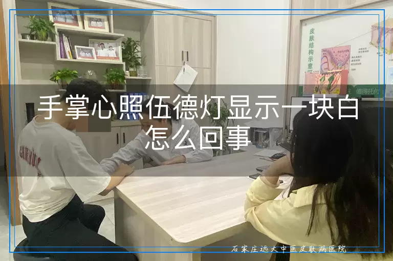 手掌心照伍德灯显示一块白怎么回事