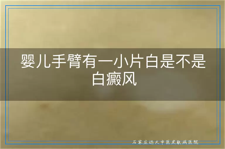 婴儿手臂有一小片白是不是白癜风