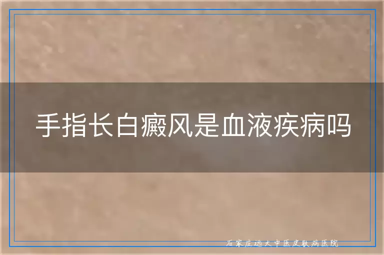 手指长白癜风是血液疾病吗