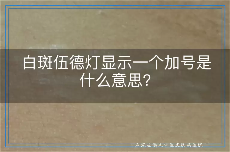 白斑伍德灯显示一个加号是什么意思？
