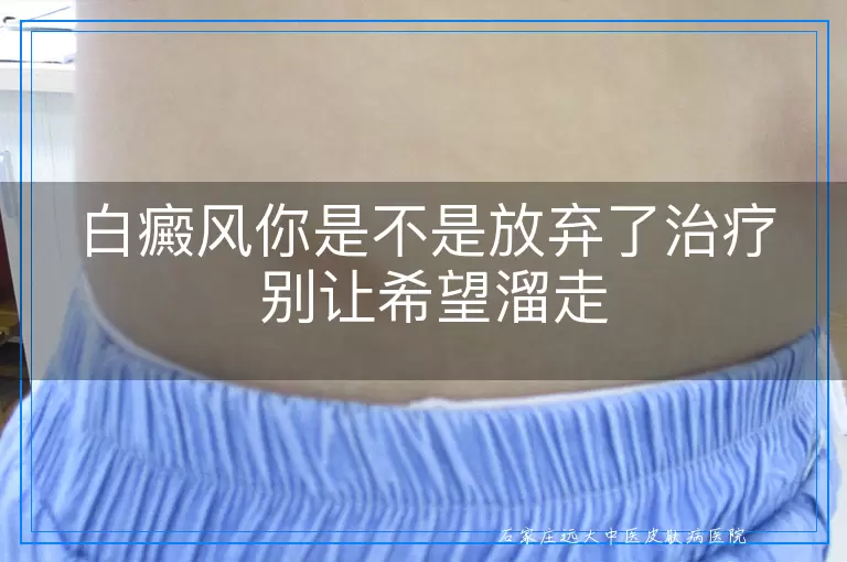 白癜风你是不是放弃了治疗 别让希望溜走