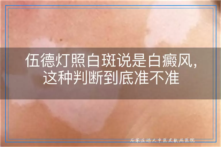 伍德灯照白斑说是白癜风,这种判断到底准不准