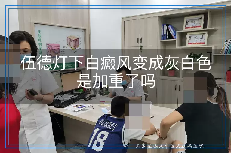 伍德灯下白癜风变成灰白色是加重了吗